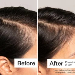 Act+Acre 3% Stem Cell Peptide Scalp Treatment 89ml