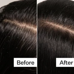 Act+Acre Cold Pressed Scalp Detox 89ml