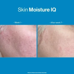 Advanced Nutrition Programme Skin Moisture IQ