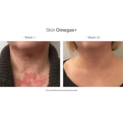 Advanced Nutrition Programme Skin Omegas+ 180 Caps