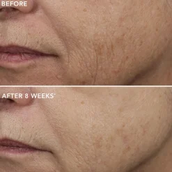 IMAGE Skincare Ageless+ Overnight Retinol Masque 0.5% Retinol Complex Travel Size