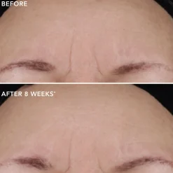 IMAGE Skincare Ageless+ Pure Liquid Retinol 0.75%