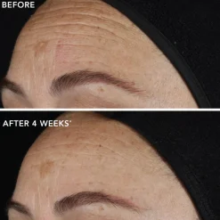 IMAGE Skincare Ageless+ Pure Liquid Retinol 0.1% Travel Size