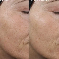 IMAGE Skincare Ageless+ Pure Liquid Retinol 0.3% Travel Size