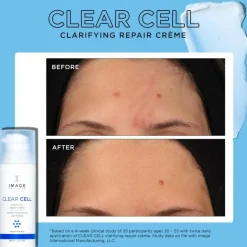 IMAGE Skincare Clear Cell Clarifying Repair Crème