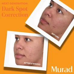 Murad Environmental Shield Rapid Dark Spot Correcting Serum