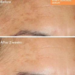 Murad Environmental Shield Vita-C Glycolic Brightening Serum