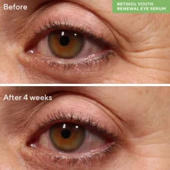 Murad Resurgence Retinol Youth Renewal Eye Serum