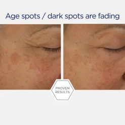 Neostrata Potent Retinol Complex