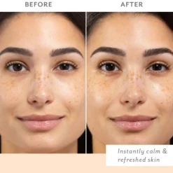 Patchology Skin Remedy Comforting Face Mask 4 Pack