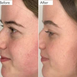 Skinician Glycolic Exfoliating Toner 100ml